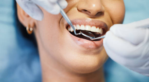 Best Emergency Dentist for Lost Fillings or Crowns in Dubuque, IA